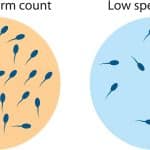 Low sperm count tips illustration showing semen sample and male fertility analysis