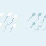 Oligoteratozoospermia illustration showing abnormal sperm shapes and low sperm quality
