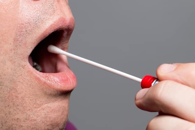 Genetic testing sperm donors man providing a saliva sample with a swab for DNA analysis