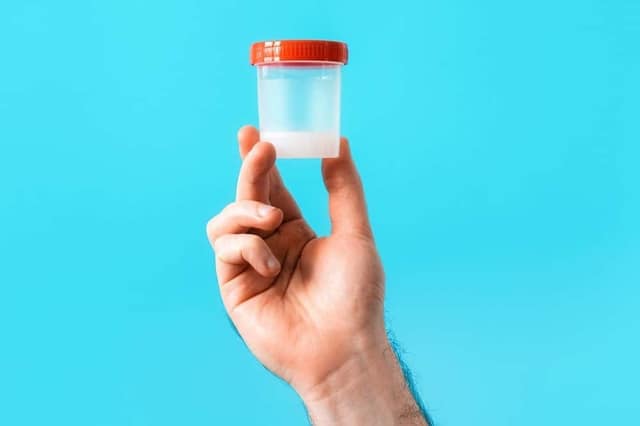 males hand holding plastic jar sperm