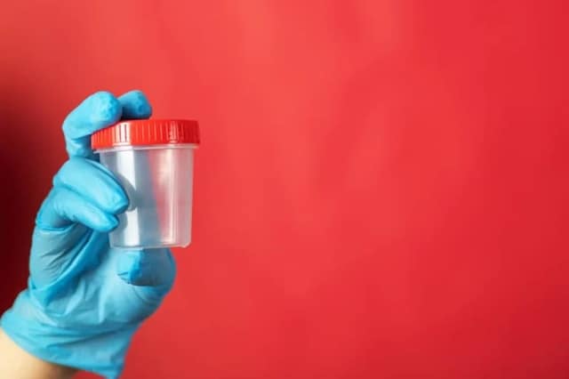 sperm-donation-jar-male-semen-sample