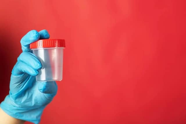 sperm-donation-jar-male-semen-sample
