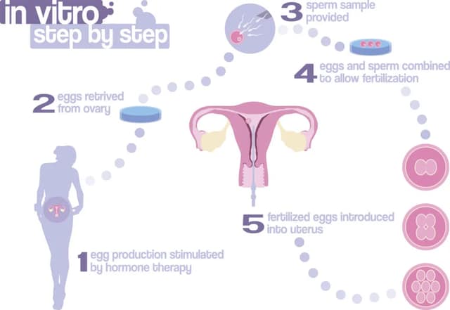 fertility preparation showing IVF process step by step from hormone stimulation to embryo transfer