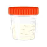 semen-analysis-sperm-sample-plastic-container-1024x1024